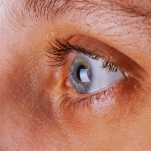 Bệnh giác mạc sợi là gì? Những nguyên nhân làm viêm giác mạc sợi