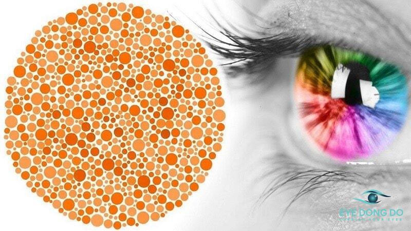 Bệnh mù màu khiến mắt bệnh nhân không thể phân biệt chính xác màu sắc