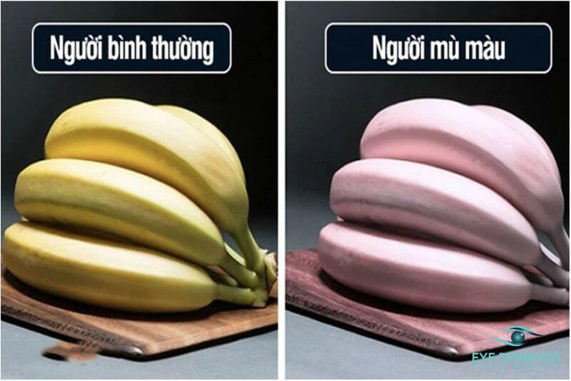 Màu sắc khi bệnh nhân mù màu nhìn thấy