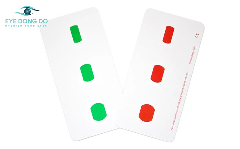 Cách chữa mắt lác tại nhà áp dụng các bài tập đơn giản