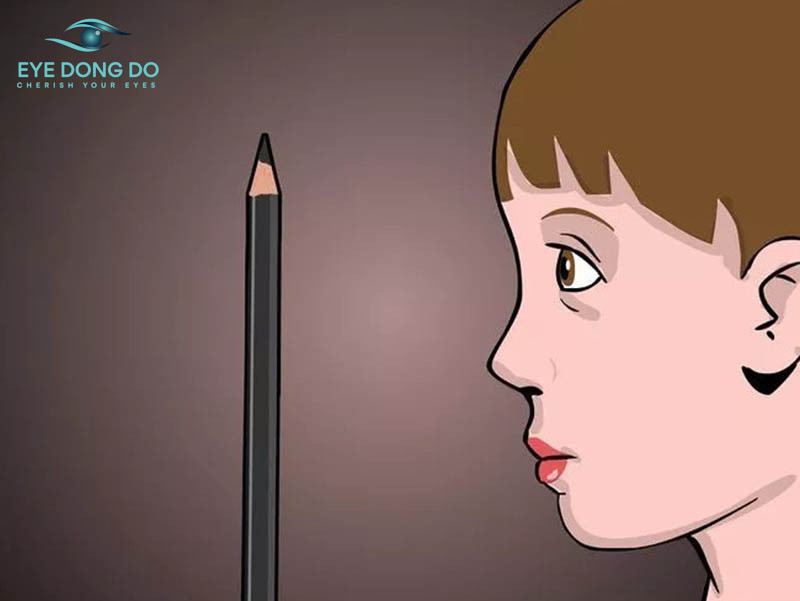 Bài tập nhìn bút chì là cách chữa mắt lác tại nhà 