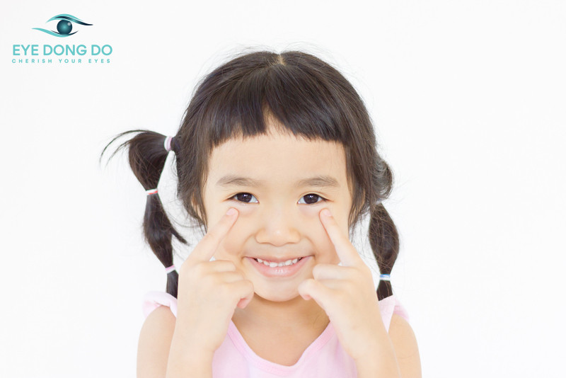 Mắt lác biểu hiện rất nhiều triệu chứng khác nhau