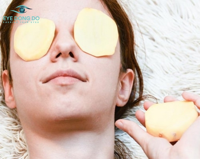 Cách giảm sưng mắt bằng khoai tây cũng được rất nhiều người ưa chuộng