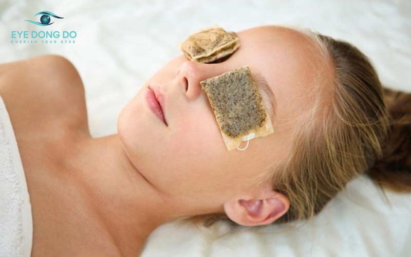 Chườm trà túi lọc là cách hết sưng mí mắt được nhiều người áp dụng