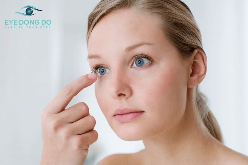 Kính áp tròng giúp cải thiện tầm nhì