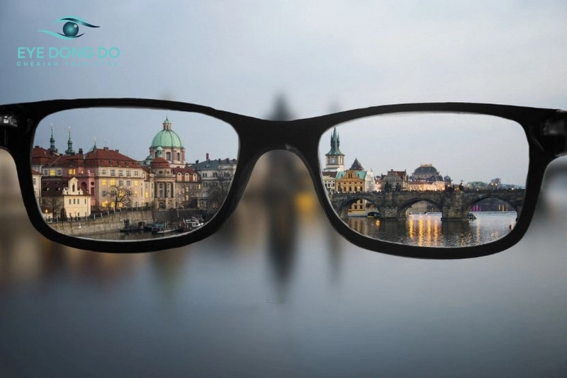 Loạn thị là tật khúc xạ thường gặp ở mắt do nhiều nguyên nhân