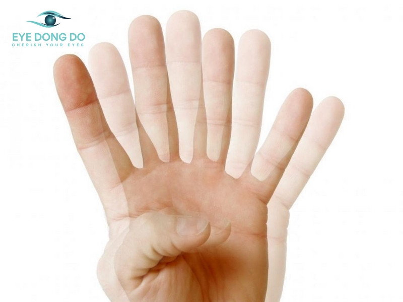 Tình trạng song thị là dấu hiệu bị loạn thị