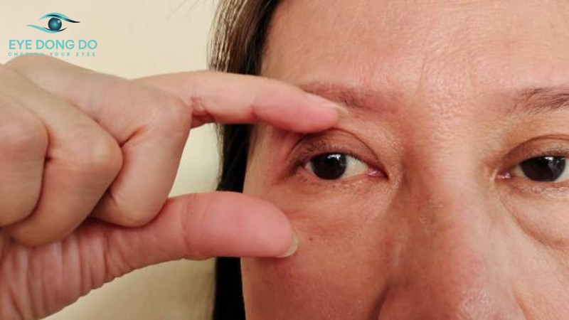 Quá trình lã hóa khiến thị lực ảnh hưởng