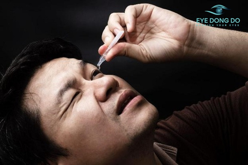 Sử dụng thuốc nhỏ mắt điều trị tăng nhãn áp