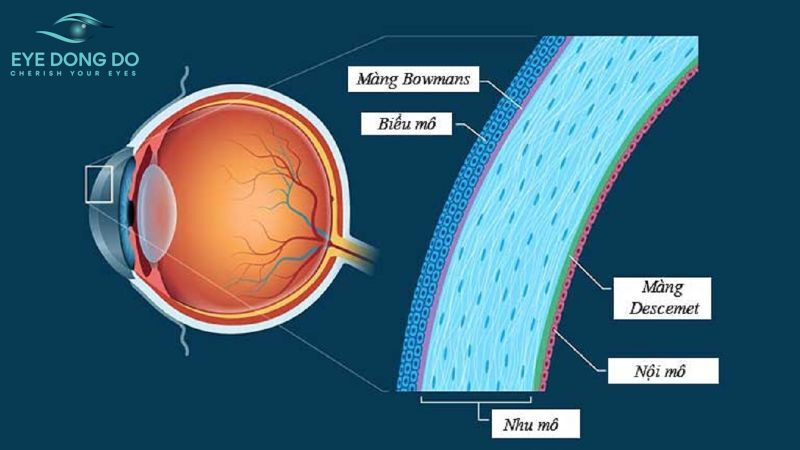 Lập bản đồ giác mạc để chẩn đoán bệnh lý giác mạc hình chóp