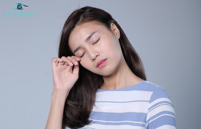 Thanh thiếu niên là độ tuổi khởi phát bệnh giác mạc hình chóp