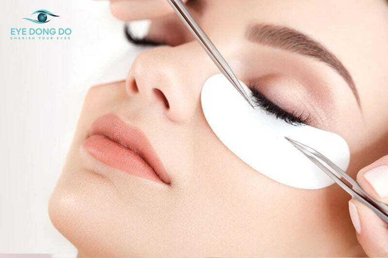 Nhổ lông xiêu là phương pháp điều trị khá phổ biến