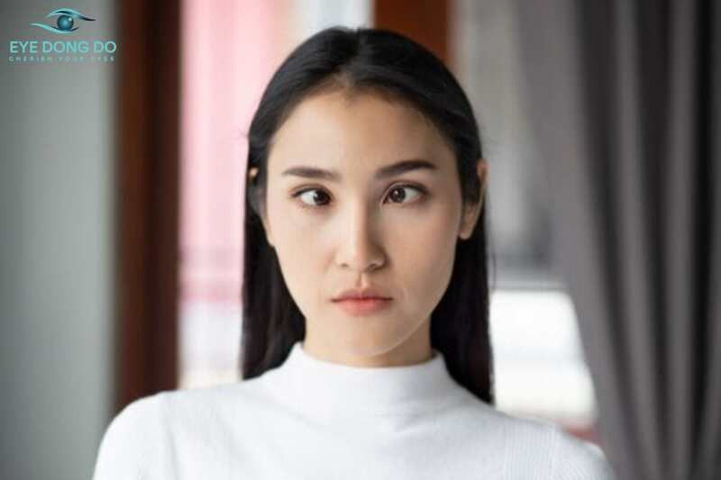 Mắt lác là biến chứng của các bệnh lý mắt