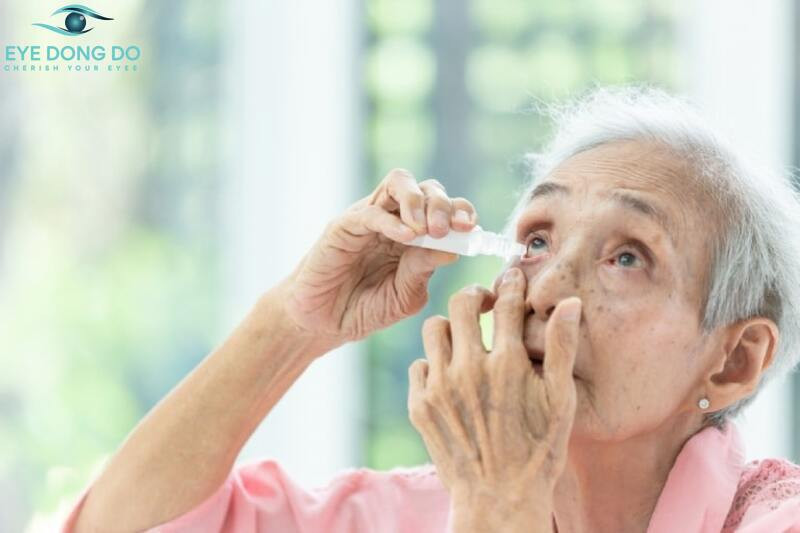 Sử dụng thuốc điều trị bệnh phù gai thị