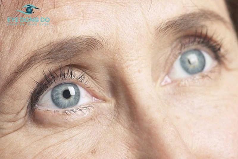 Người cao tuổi có nguy cơ cao mắc thoái hóa điểm vàng