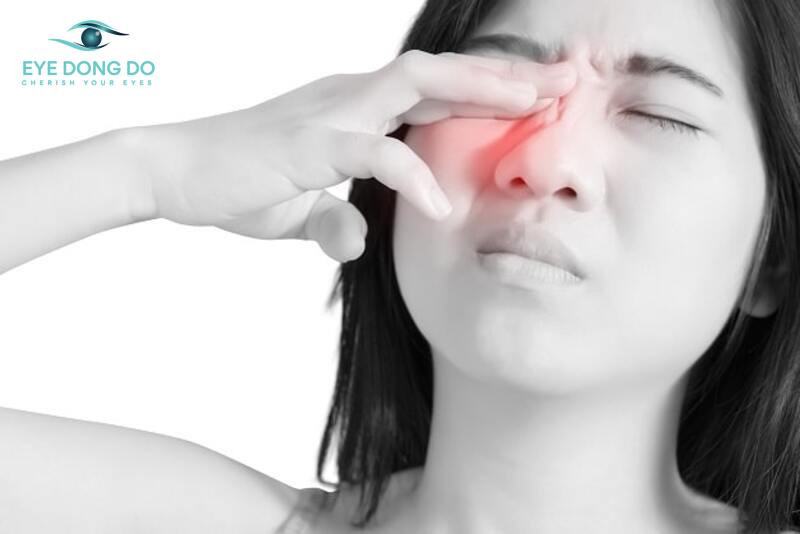 Đau nhức mắt là triệu chứng dễ nhận thấy nhất khi mắc bệnh