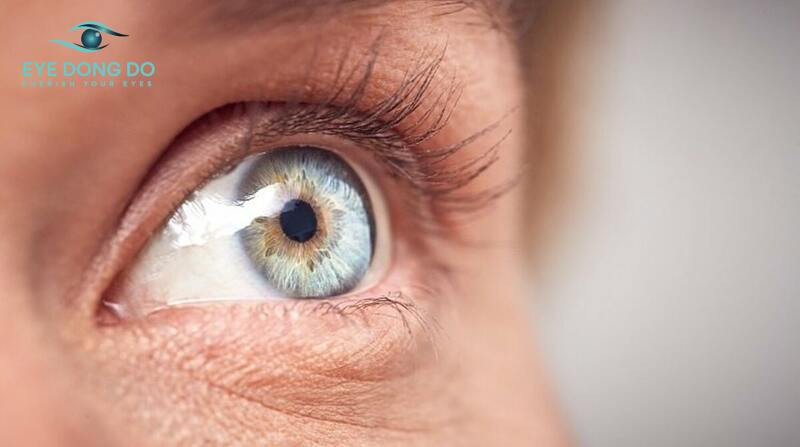 U hốc mắt có thể gặp phải ở mọi đối tượng